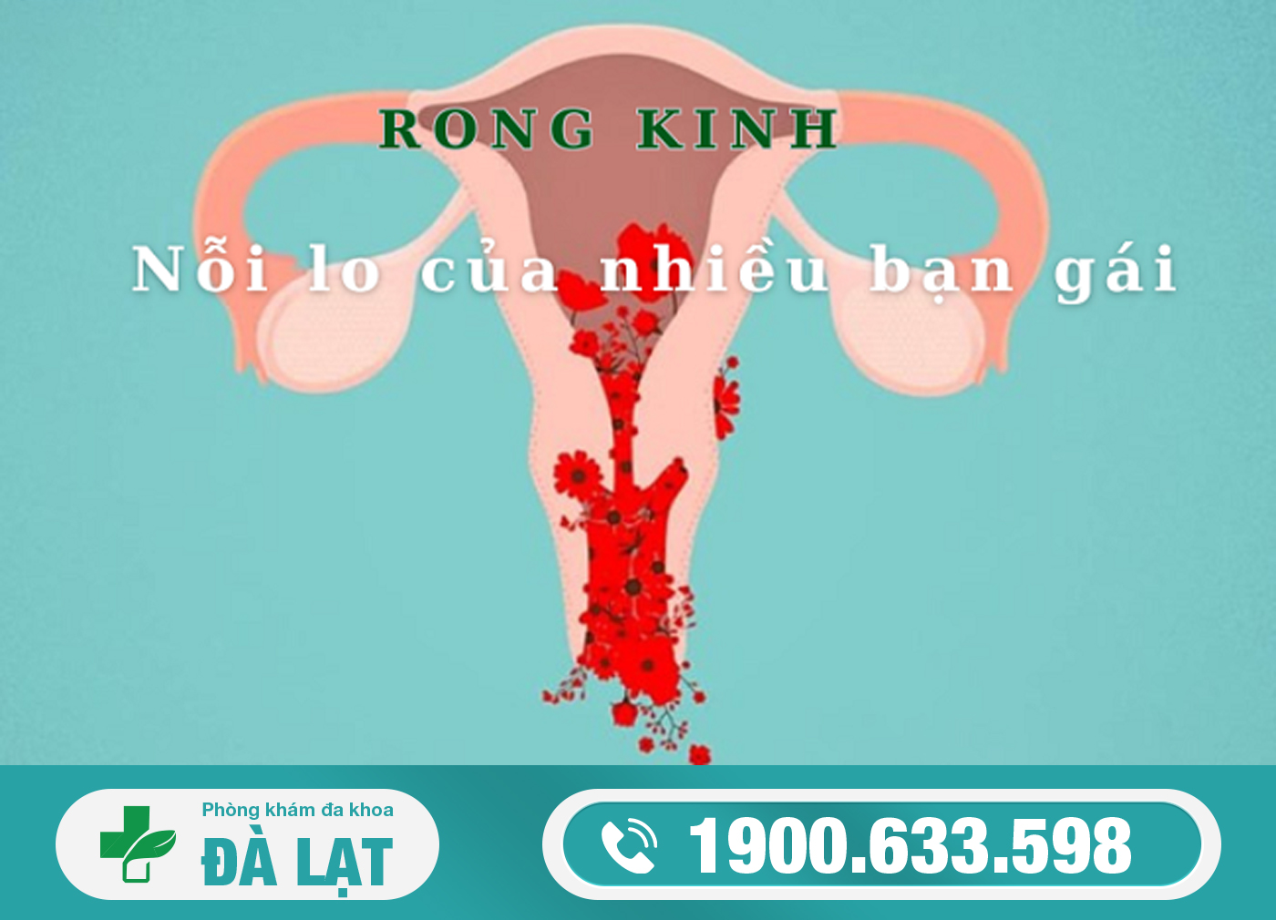 Hình ảnh minh họa